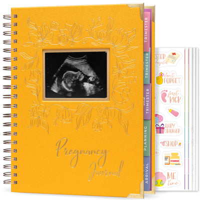 Pregnancy Journal & Memory Book (SonoFrame Edition)